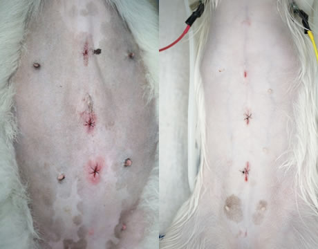 腹腔鏡手術の特徴