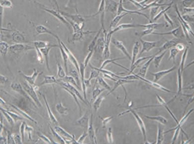 がん免疫細胞療法とその種類
