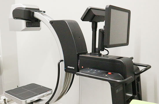 軽量X線透視診断装置