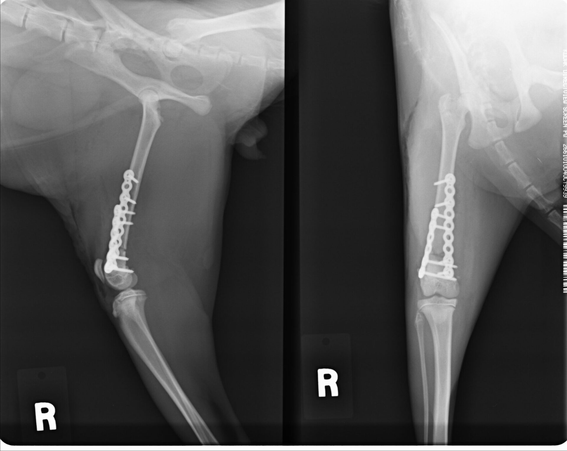 骨端部骨幹端骨折（術後）